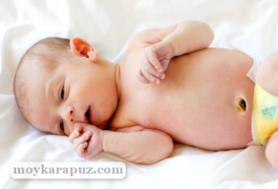 Фунгус пупка у новорожденных: что это такое и как лечить