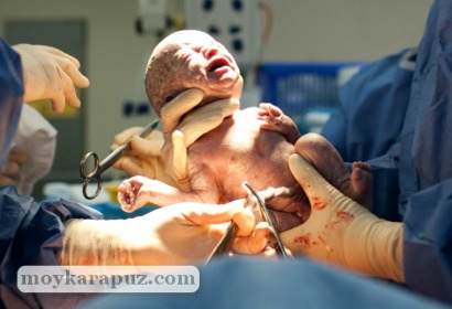 Рождение малыша