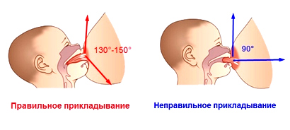 Правильно прикладывание к груди